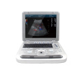 Contec Handheld Human Color Doppler Sistema de diagnóstico ultrasónico Máquina de ultrasonido digital CMS1700A